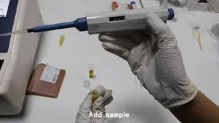 Semi-auto biochemistry analyzer operation video