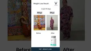 Weight Loss Powerful Results! 🔥 VGP Life Testimonial | Real Transformation Story