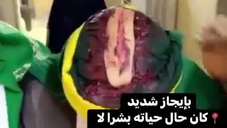 yadda yan shiraziyya suke yanka jikinsu