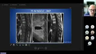 Spinal Intervention teaching