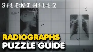 Silent Hill 2 Remake - X-Ray Puzzle Guide (Standard Difficulty)