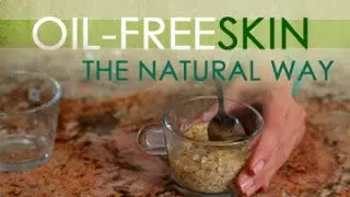 The Alternative - EP8 - Oil-Free Skin - Myx TV