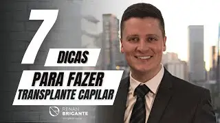 7 Dicas Para um Transplante Capilar de SUCESSO!