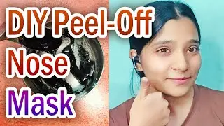 DIY Peel-Off Nose Mask to Remove Blackheads & Whiteheads | Best Peel Off Mask for Blackheads Removal