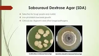 Selective and Differential Media in identifying bacteria