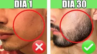 Como Fazer a Barba Crescer em Quem N&atilde;o Tem