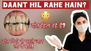 How to stop loose teeth?😬 | Fix for loose teeth! How to stop it | #loosetooth #toothpain