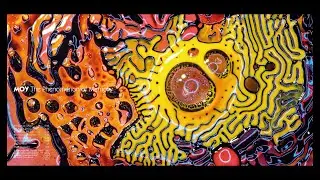 MOY -- Positron Emisson