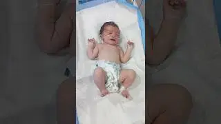 Newborn Baby in Unstable Condition &ndash; Distress, Delayed Cry & Continuous Fits#cute #baby #feedingtube