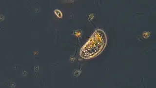 Trithigmostoma - a cell with teeth