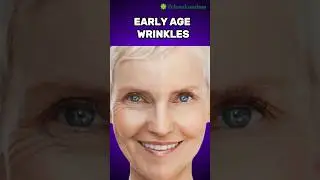 Why Do We Get Wrinkles? The Science Behind Aging Skin 🧴✨ #shorts #48
