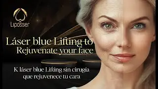 K Laser Blue lifting, rejuvenece tu cara sin cirug&iacute;a.