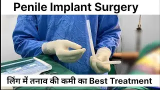 Penile Implant In Raipur | Penile Implant Surgery Cost In Raipur | Zenith Clinic