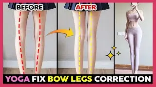 🔥BEST YOGA TO FIX BOW LEGS CORRECTION | Get Straight & Longer Legs, Perfect Legs Shape Exercise