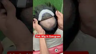 Hair Wig In Gurugram Price | 9990115900 | Best Hair Wig In Gurgaon | Hair Patch In Gurgaon #gurugram
