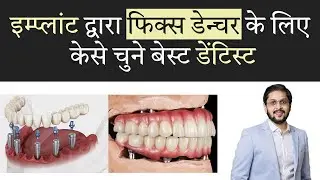 Computer-Driven Fix Denture के लिए Best Dentist कैसे चुनें? 🦷 | Fixed Denture in Indore