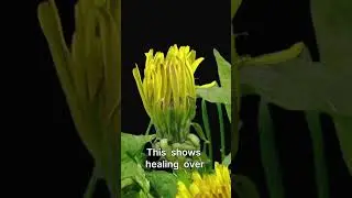Why Do Bruises Change Color? | Super Simple Explanations