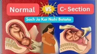 Normal Delivery vs C-Section 🤰 | Pain, Recovery & Real Truth