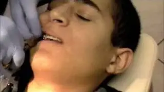 Removing Braces 2