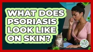 What Does Psoriasis Look Like On Skin? - Allergy Relief Guide