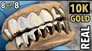 Real Solid 10K Gold Custom Grillz 8 on 8 Teeth Grills Set - BlingCartel.com