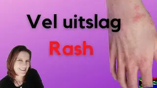 Home remedies for skin rashes and itching / Raad vir vel uitslag