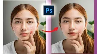 Remove Pimples and Acne in Photoshop,  Smooth Skin Retouching Tutorial