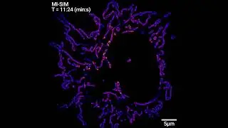Ultra low Photobleaching   #MI-SIM#