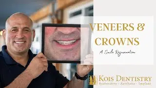 Restoring Years Worth of Damage With A Smile Rejuvenation