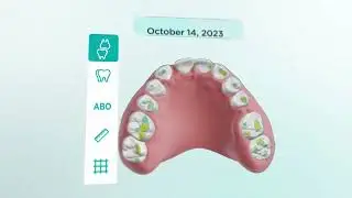 DentalMonitoring+ Explained