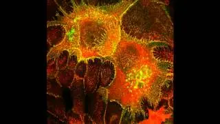 Dissecting the signalling role of human desmoglein 3, the pemphigus vulgaris antigen