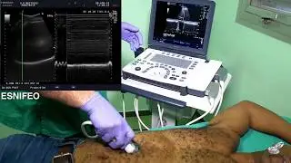 Ecografía pulmonar y diafragmática/Lung ultrasound