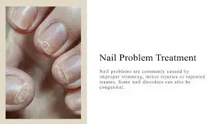 Heel Pain Houston