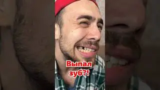 Что делать если выпал зуб