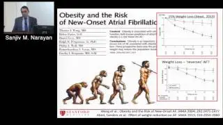 Novel Mechanistic Insights in Atrial Fibrillation (Sanjiv Narayan, MD) Nov 3, 2016
