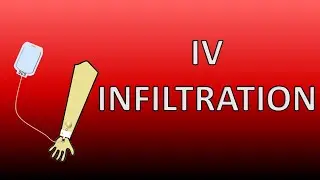 IV Infiltration (Leakage through insertion site) | Signs & Symptoms | Causes | Management