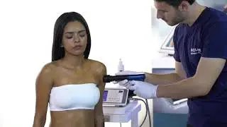 ESWT Tedavi Uygulamaları ESWT Treatment Trigger Points Calcific Tendinitis