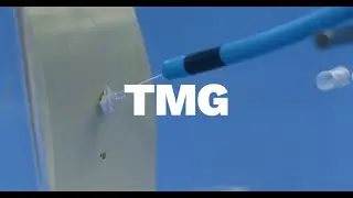 Tricuspid Valve Repair Technology : Trialign | Precruiting