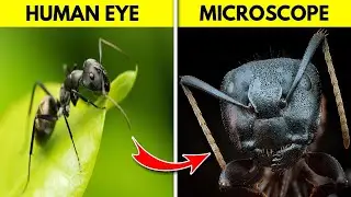 12 Things You Can See Only Under Microscope | Adrees Tv