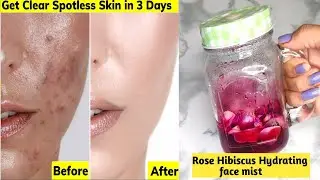 Summer skincare: HYDRATE Your Skin with ROSE Hibiscus Face Mist! Hydrating mist/Rose water
