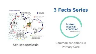 Schistosomiasis | Bilharzia | Snail fever