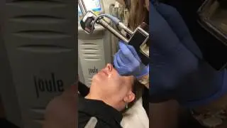MicroLaserPeel Procedure at The MedSpa