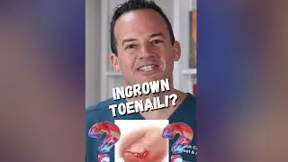 WHAT CAUSES INGROWN TOENAILS!? Don&rsquo;t let this happen! #shorts