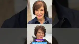 Fuller Hair by Replicating Real Hair Growth Breakthrough Technology for Women 45+ with Micro Strand