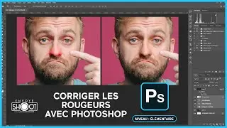 Corriger les rougeurs avec PHOTOSHOP