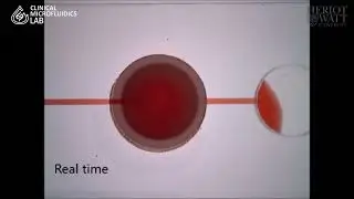 Integrated Microfluidic filter for RBC debris ESI Video 5