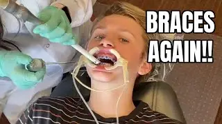 Kamden Gets Braces Again!!