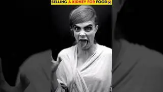 Selling a Kidney For Food😭 Kidney Valley🙄 |Some dirty facts You don't Know😮| Ayaz Facts #shorts