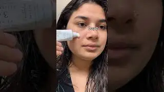 Dr.althea 345 relief cream ✅❤️ #brightskin #skincare #australia