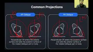 ROUTINE AND SPECIAL PROJECTIONS RADIOGRAPHY _ ALI